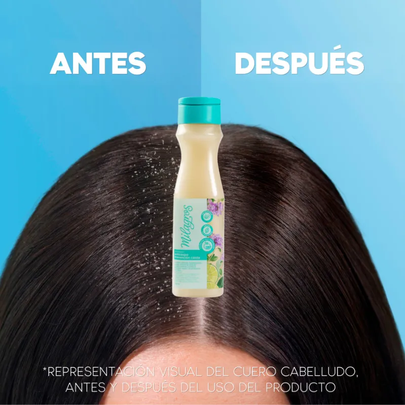 Milagros - Shampoo anticaspa milagros