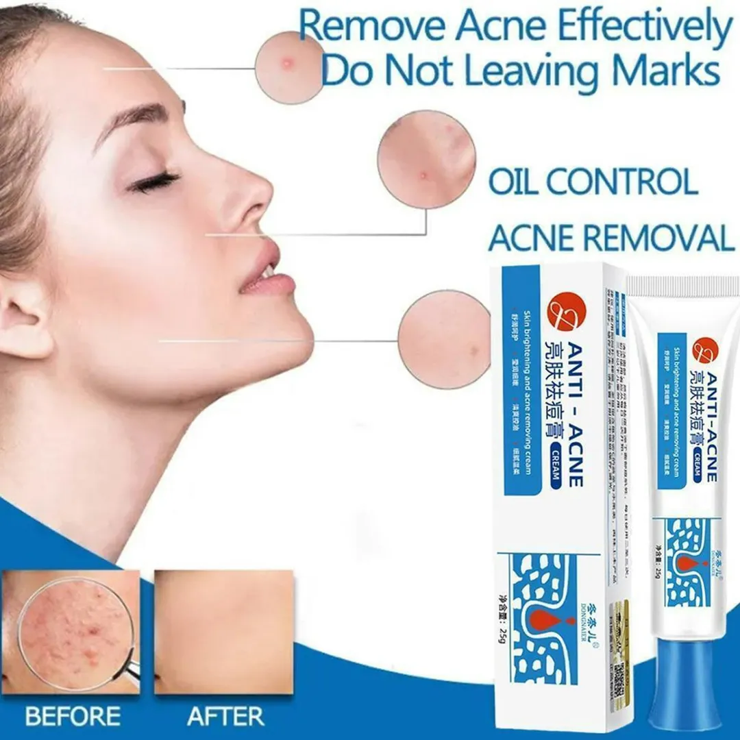 KISS BEAUTY - CREMA CONTROL ANTI ACNE KIS BEAUTY