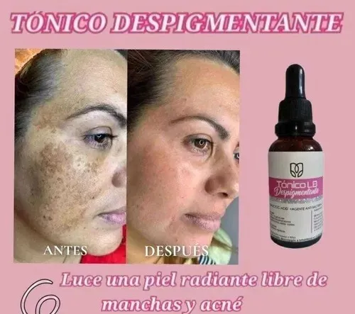 Tonico LB DESPIGMENTANTE