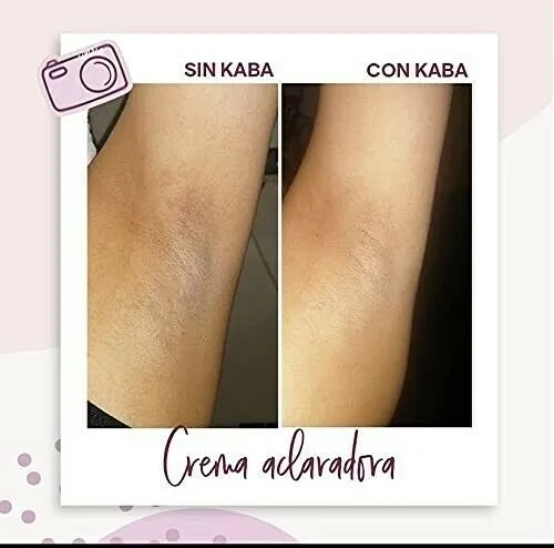 KABA - Crema aclarante KABA